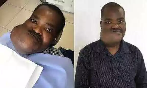 Security Guard With Large Tumour On His Face Sacked After Customers Complained About His Looks [Photos]